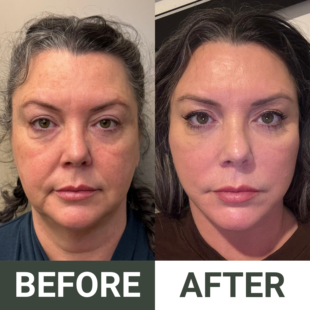 CLEANSL8® Advanced Multi-Target Cleanse