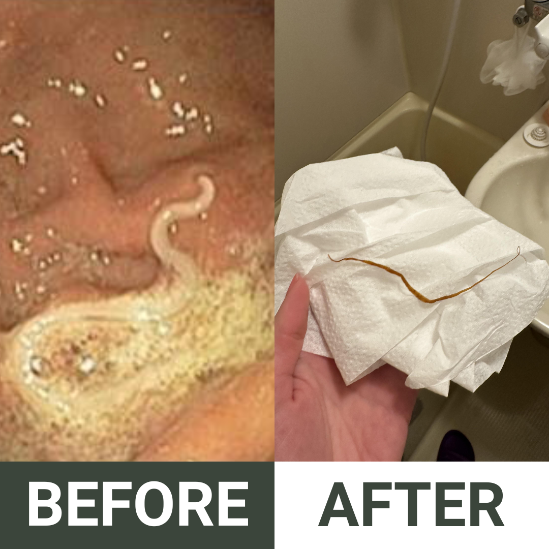 CLEANSL8® Berberine & Sodium Alginate Parasite & Microplastics Cleanse