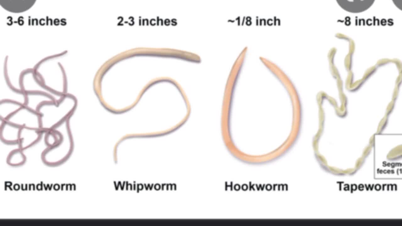 Chart of common worms: roundworm 3 to 6 inches, whipworm 2 to 3 inches, hookworm about 1/8 inch, tapeworm about 8 inches