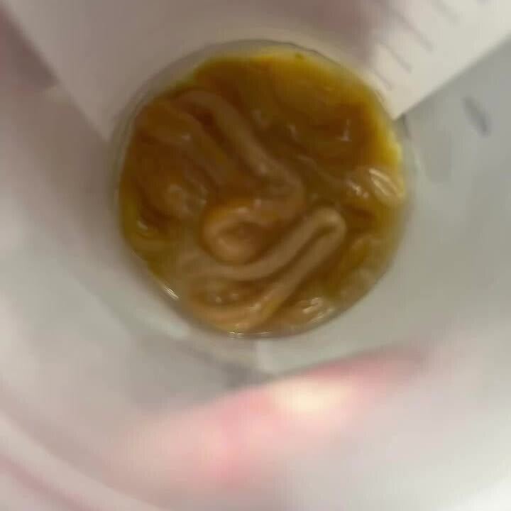 Worms she collected in a cup