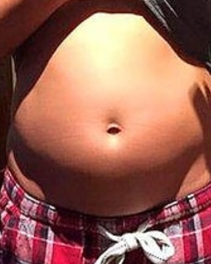 Her bloated stomach on a normal afternoon