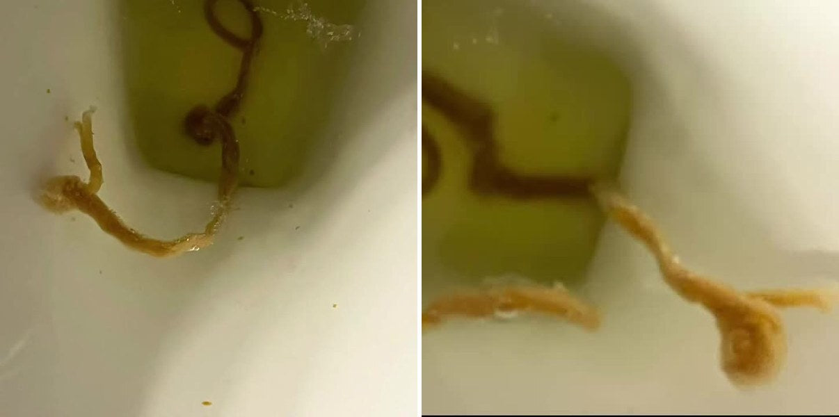 The first worm she passed, in the toilet
