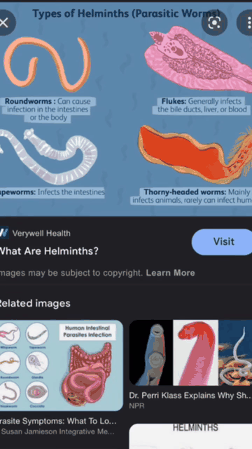 Her phone showing Google Images results for types of parasitic worms