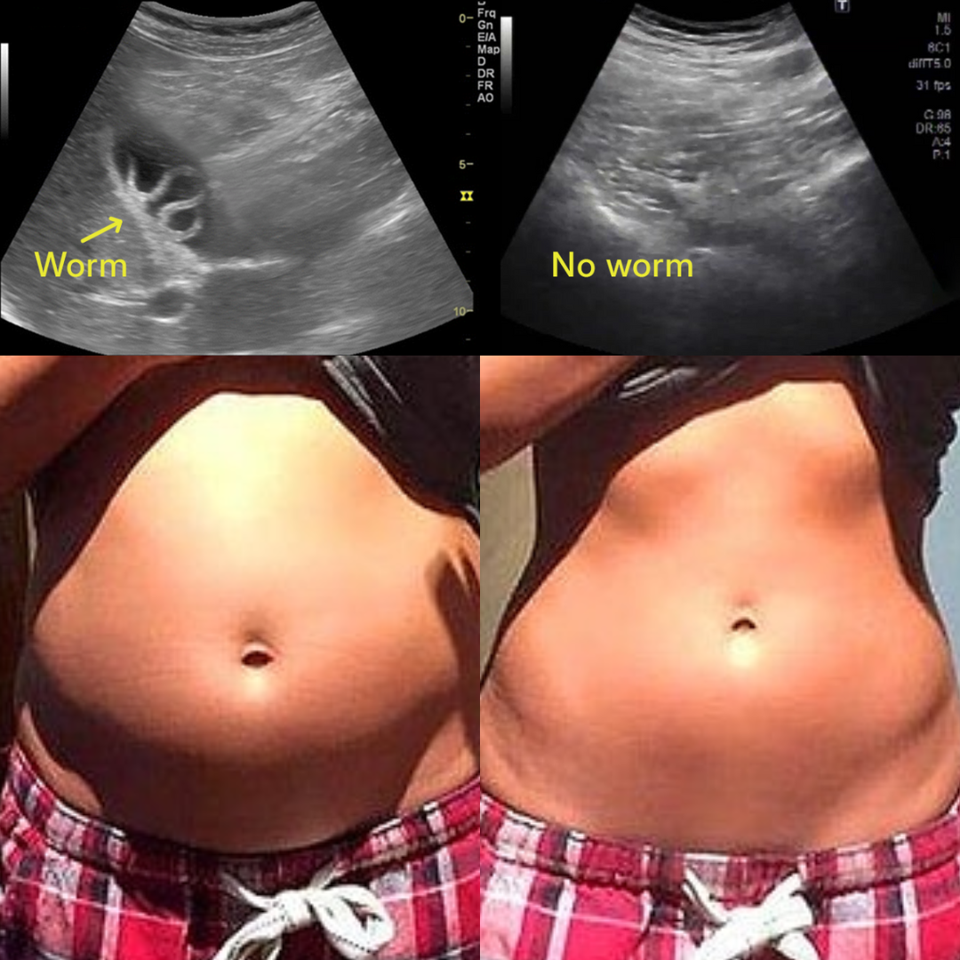 New Maximum Potency Formula - Berberine & Sodium Alginate Parasite & Microplastics Cleanse