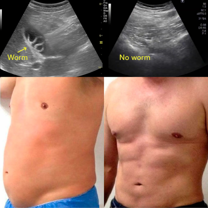 New Maximum Potency Formula - Berberine & Sodium Alginate Parasite & Microplastics Cleanse