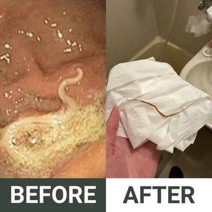 CLEANSL8® Berberine & Sodium Alginate Parasite & Microplastics Cleanse