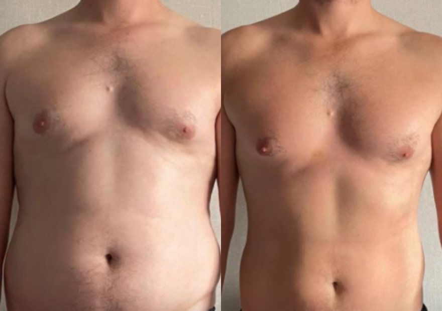 James W. before and after CLEANSL8