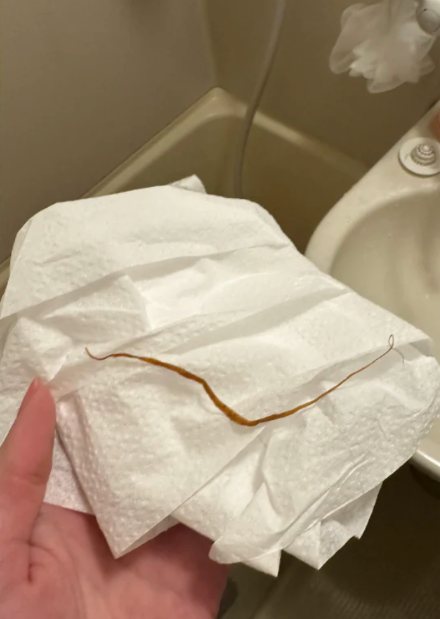A parasite passed after the cleanse
