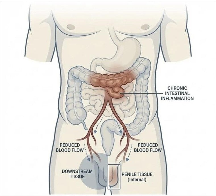 Diagram showing how chronic intestinal inflammation restricts blood flow to penile tissue