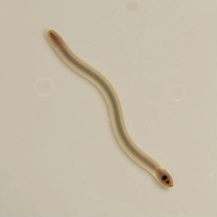 A tall glass of clean-looking water; a single drop magnified under a microscope reveals a parasite