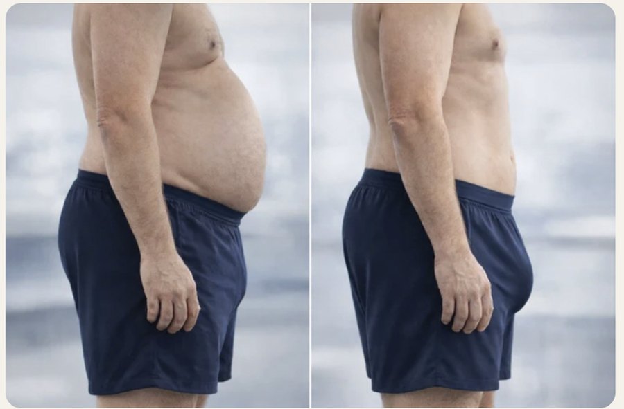 Side profile before and after showing a reduced belly after the cleanse