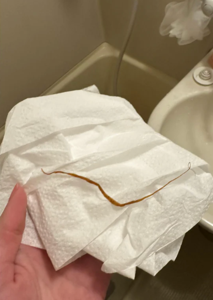 A worm passed after the cleanse