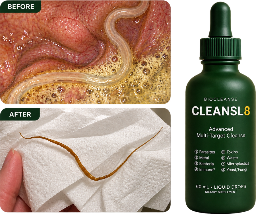 Before: a worm on the gut wall. After: a worm passed following the cleanse, beside the CLEANSL8 bottle