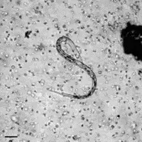Microscope footage of a live parasitic worm