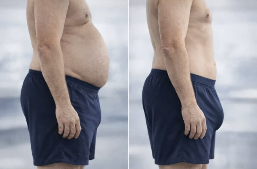 Side profile before and after showing a flatter stomach after the cleanse