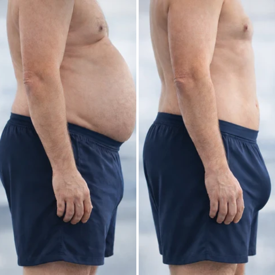 Before and after side profile of a man, flatter midsection after clearing the buildup