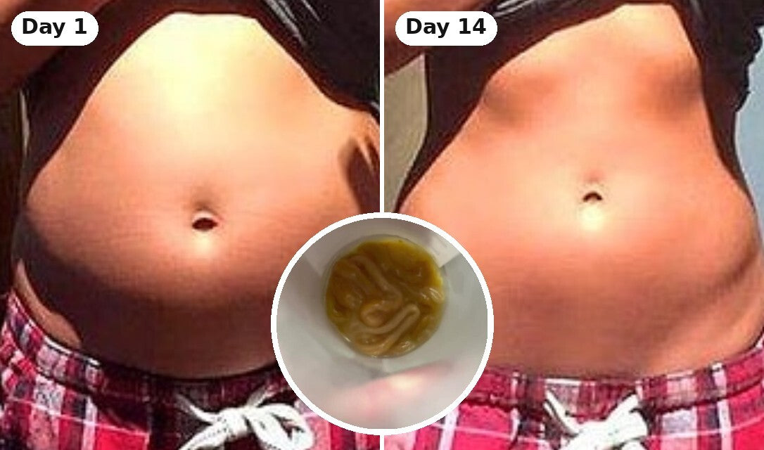 Her belly bloated on day 1 and flat on day 14, with a cup of the worms she passed in a circle in the middle